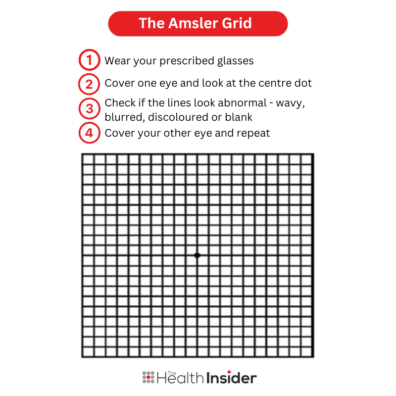 Amsler grid for AMD