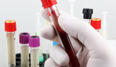 Blood Tests