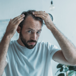 Male Pattern Hair Loss