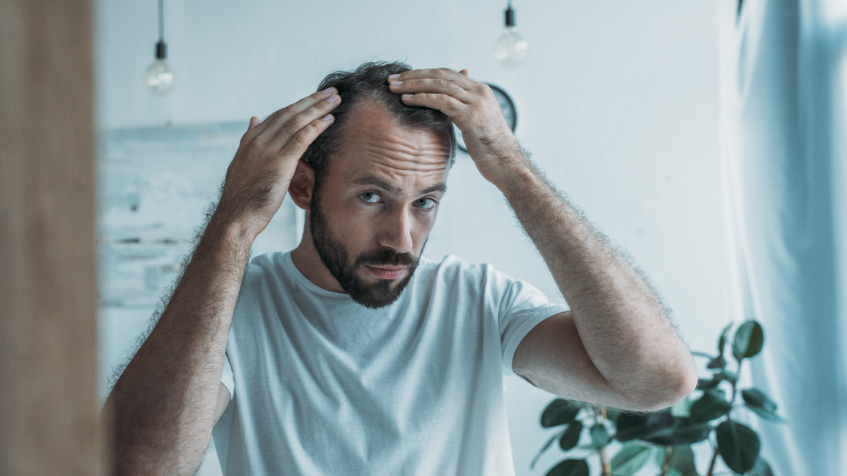Male Pattern Hair Loss